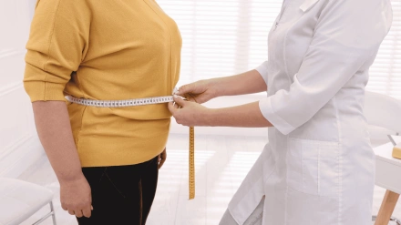 (Foto de ARCHIVO)Médico midiendo el perímetro abdominal de un paciente con obesidad.REMITIDA / HANDOUT por QUIRÓNSALUDFotografía remitida a medios de comunicación exclusivamente para ilustrar la noticia a la que hace referencia la imagen, y citando la procedencia de la imagen en la firma07/2/2025