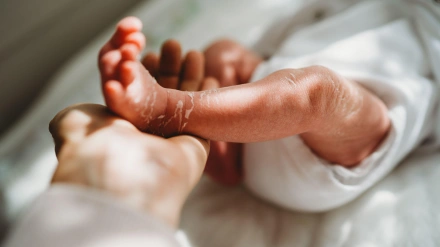 Mano de mamá sosteniendo los pies de un bebé recién nacido con la piel descamada