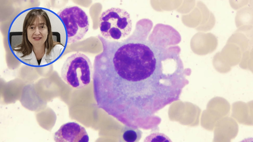 Mieloma múltiple; arriba, a la izquierda, la doctora Esther González