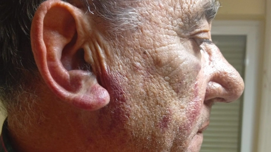 Luis María Melón, alcalde de Alesón