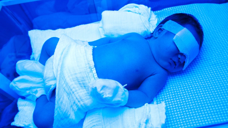 Bebé recién nacido con ictericia bajo luz ultravioleta en la incubadora.