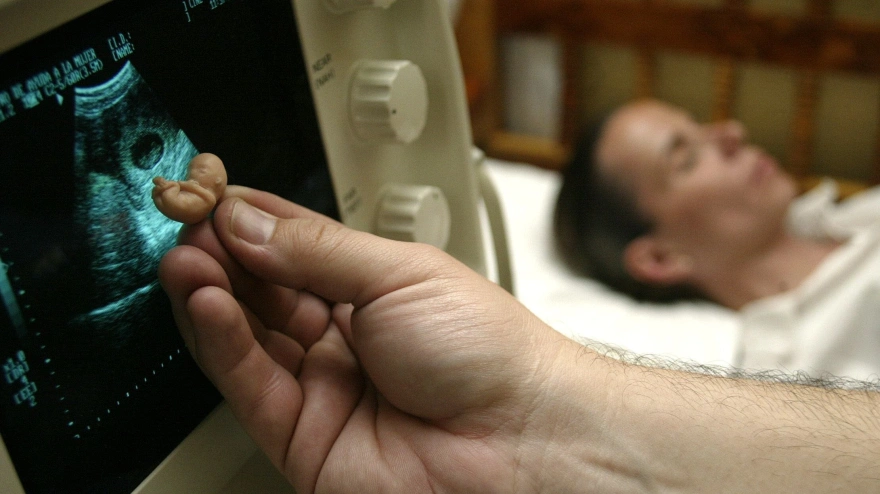 Mayela Bolado, de 31 años, durante una ecografía en su novena semana de gestación