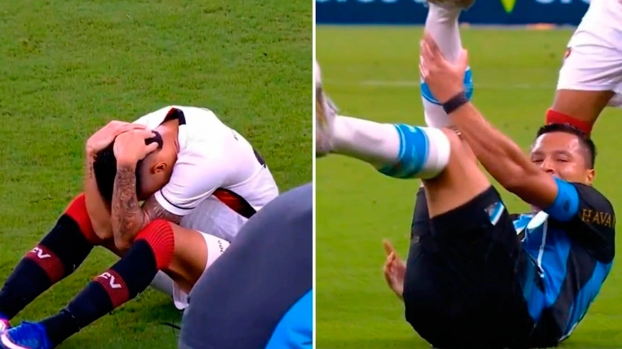 Terrible lesión de Marlon durante el Gremio-Vitoria de Guimaraes de la Liga Brasileña