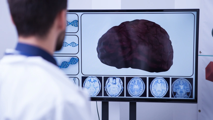 Young doctor checking a brain after nerve surgery. Brain with severe problems.