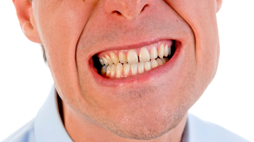 BFCH58 mouth. Image shot 2007. Exact date unknown.